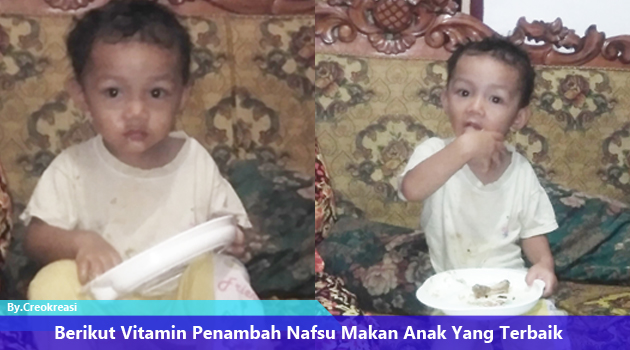 Vitamin Penambah Nafsu Makan Anak